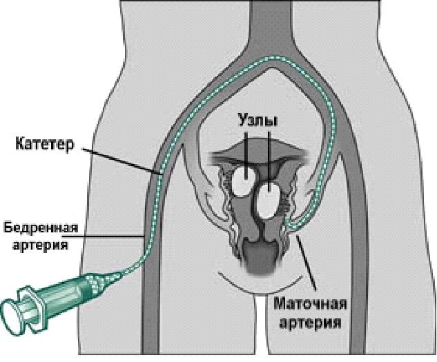 http://mioma2006.narod.ru/emblization.JPG